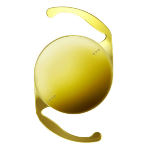 AcrySof IQ Toric SN6ATT