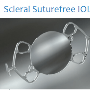 Scleral Suturefree IOL Carlevale (Soleko)