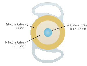 HARMONIS Swiss Advanced Vision